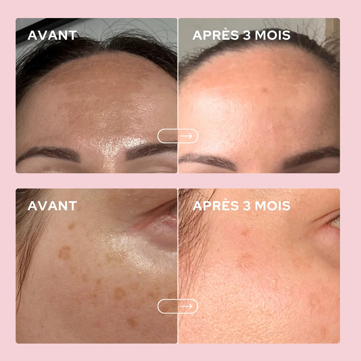 Poudre anti-taches - Epycure (Nouveauté en précommande)